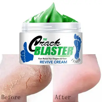 15 g/ 30g/ 50g Popraskané Päty Repair Cream Skin Suché Nohy Liečba Hlboko Hydratujú Drsné Suché Nohy Starostlivosť Repair Cream
