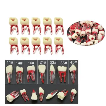 Zubné Typodont RCT Root Kanály Praxi Buničiny Štúdia Endodotic Zuby Model